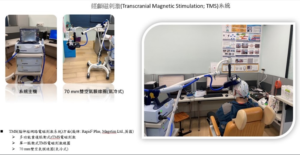 經顱磁刺激系統(TMS)